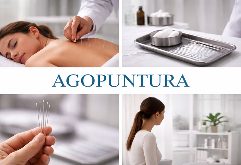 agopuntura